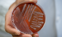 New developments in classical culture techniques have made it possible to research bacteria that could previously hardly be cultivated in the laboratory. (c) Medical Center - University of Freiburg