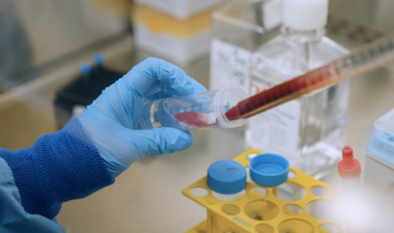 Blutproben von Heptatitis-C-Patient*innen wurden im Labor untersucht und so entscheidende Veränderungen festgestellt. ©Universitätsklinikum Freiburg