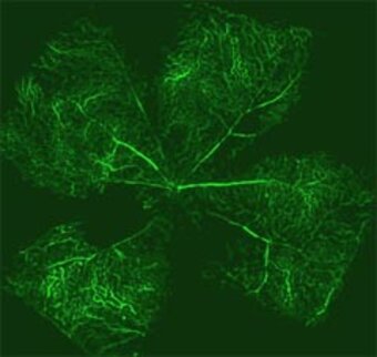 Retina einer Maus mit retinalen Gefässen, die durch Perfusion mit einem Fluoreszenzfarbstoff (Fluorescein) sichtbar gemacht wurden. Retina einer Maus mit retinalen Gefässen, die durch Perfusion mit einem Fluoreszenzfarbstoff (Fluorescein) sichtbar gemacht wurden.