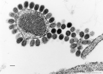 Influenzaviren, © Hans R. Gelderblom, RKI 