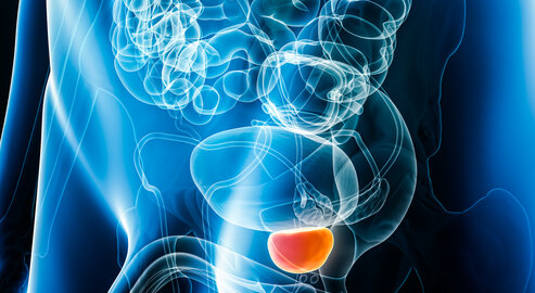 Die HypoFocal-SBRT Studie des Universitätsklinikums Freiburg untersucht eine hochpräzise Bestrahlung von Prostatakrebs, die Tumorgewebe gezielt behandeln und umliegendes Gewebe schonen soll. © Adobe Stock