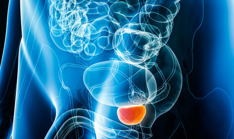 Die HypoFocal-SBRT Studie des Universitätsklinikums Freiburg untersucht eine hochpräzise Bestrahlung von Prostatakrebs, die Tumorgewebe gezielt behandeln und umliegendes Gewebe schonen soll. © Adobe Stock Die HypoFocal-SBRT Studie des Universitätsklinikums Freiburg untersucht eine hochpräzise Bestrahlung von Prostatakrebs, die Tumorgewebe gezielt behandeln und umliegendes Gewebe schonen soll. © Adobe Stock
