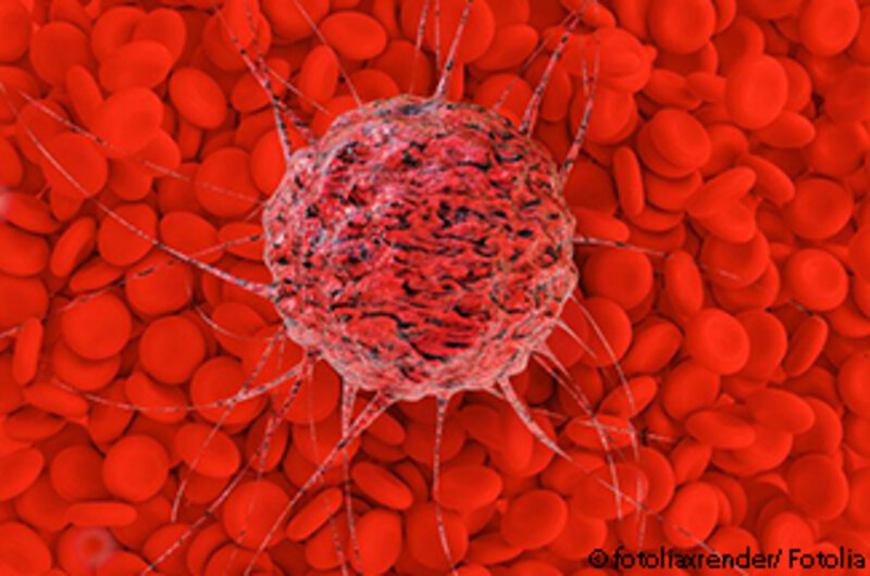 Das Forschungsteam konnte 11.000 Genmutationen auf ihre Bedeutung in Krebszellen bewerten. (c)Fotolia