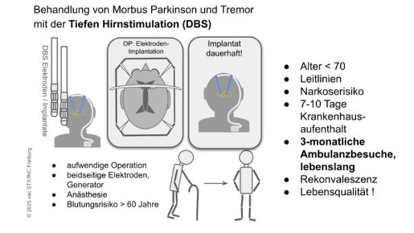 Tiefe Hirnstimulation