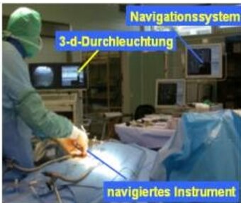 Neuro navigation Neuro navigation