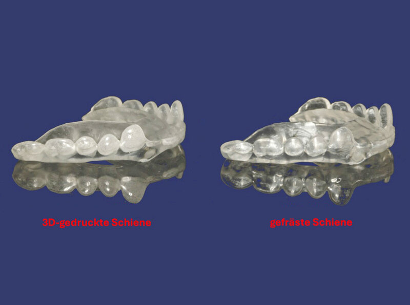 3D-Druck von Zahnschienen 3D-Druck von Zahnschienen