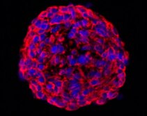 Brain tumor isolated cells