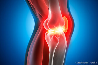 Schmerzendes Knie