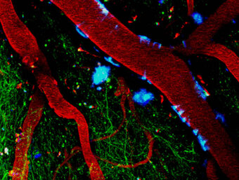 2-Photon microscopy