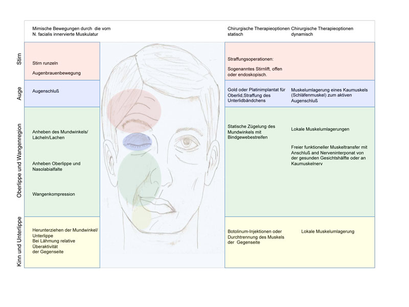 Therapie der Fazialislähmung  Universitätsklinikum Freiburg